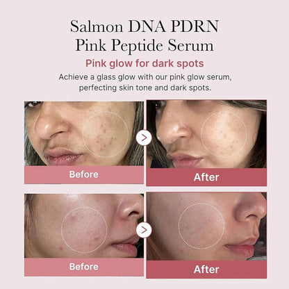 Medicube Salmon DNA PDRN Pink Peptide Serum
