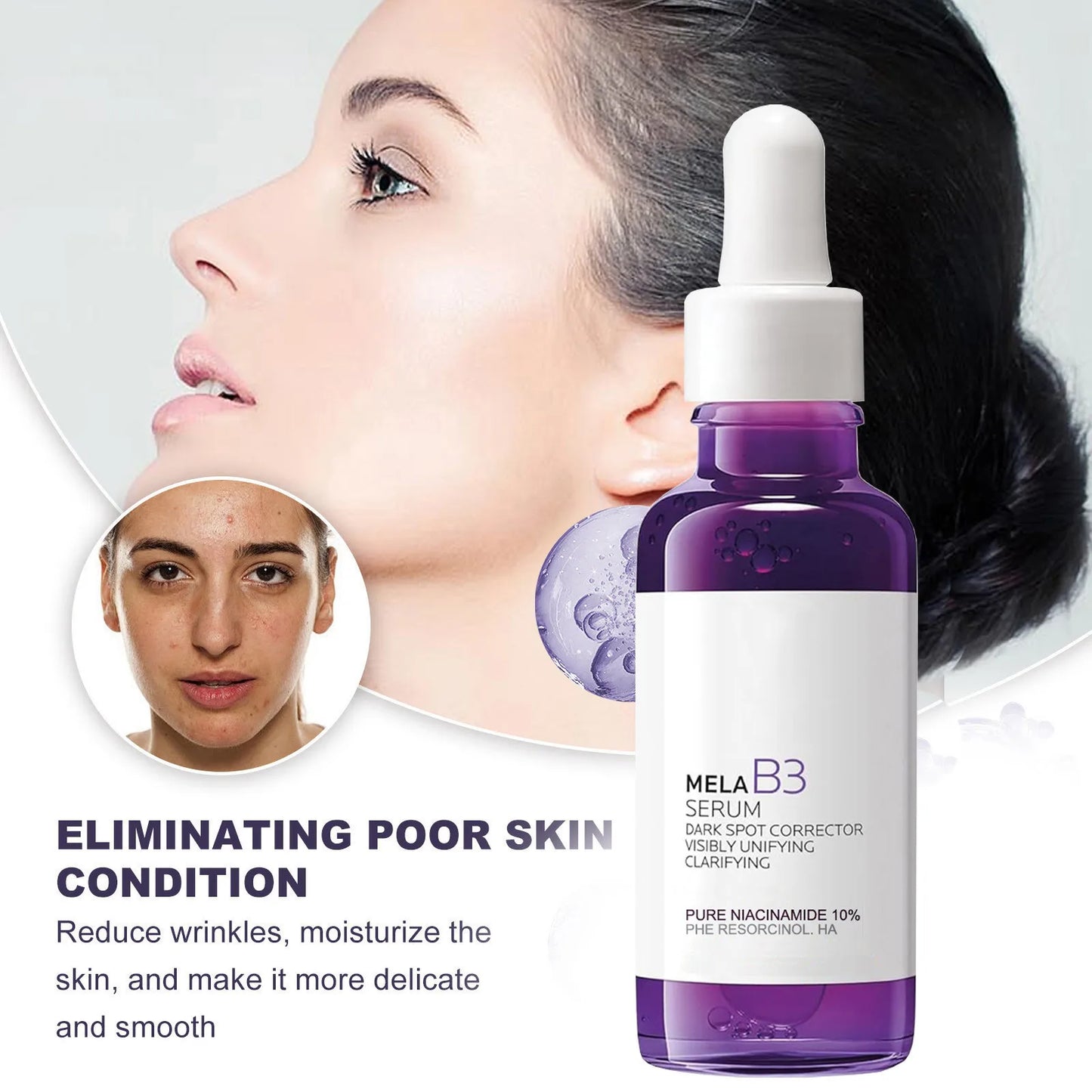 5-in-1 Rice & Vitamin C Brightening Essence — Anti-Aging Dark Spot Corrector