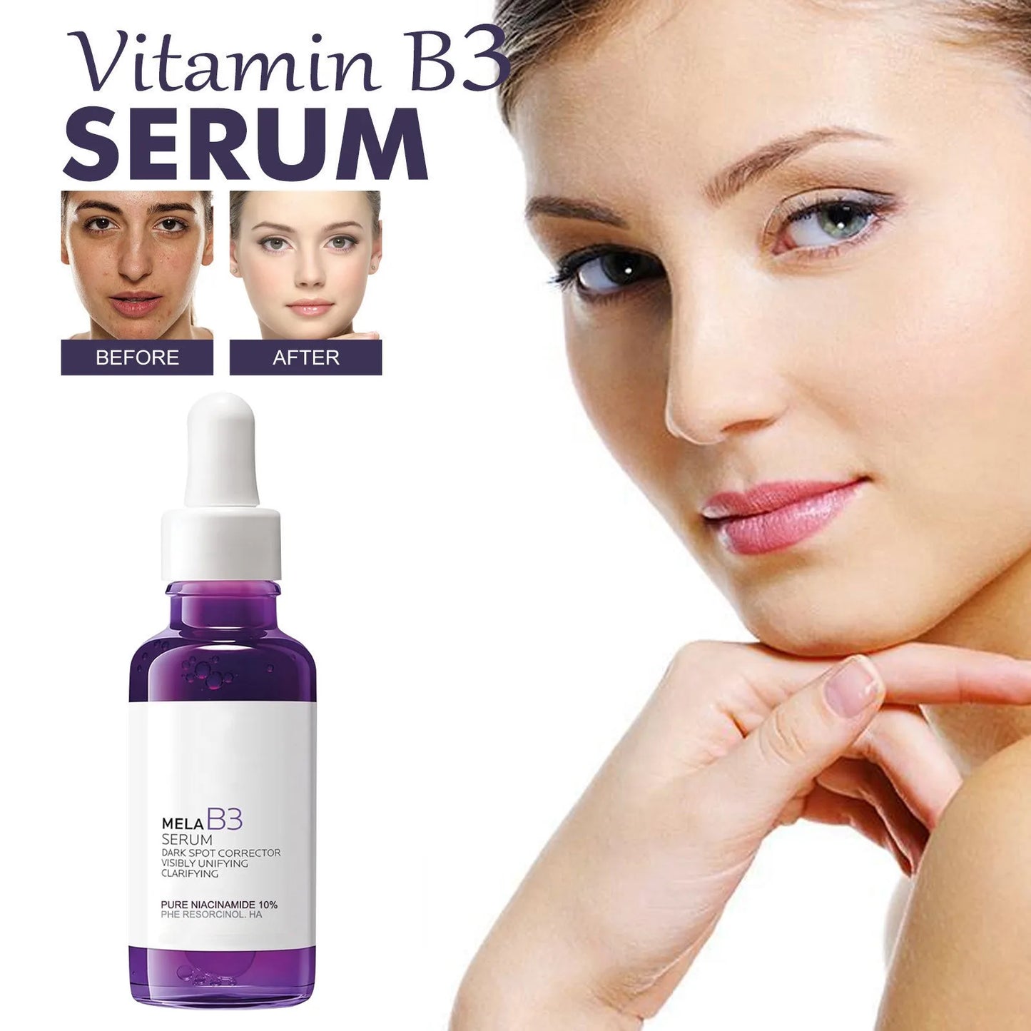 5-in-1 Rice & Vitamin C Brightening Essence — Anti-Aging Dark Spot Corrector