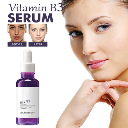 5-in-1 Rice & Vitamin C Brightening Essence — Anti-Aging Dark Spot Corrector
