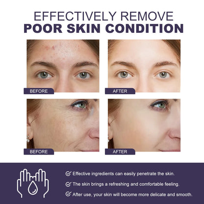 5-in-1 Rice & Vitamin C Brightening Essence — Anti-Aging Dark Spot Corrector